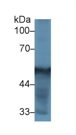 Polyclonal Antibody to Cytochrome P450 2D6 (CYP2D6)