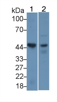 Polyclonal Antibody to Casein Kinase 1 Delta (CSNK1d)