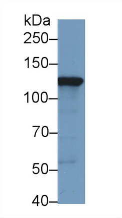 Polyclonal Antibody to Hexokinase 2 (HK2)