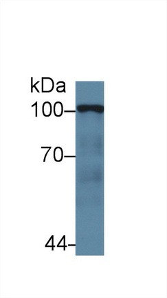 Polyclonal Antibody to Hexokinase 2 (HK2)