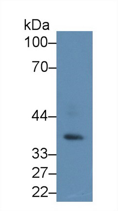 Polyclonal Antibody to Protein Kinase, AMP Activated Gamma 1 (PRKAg1)