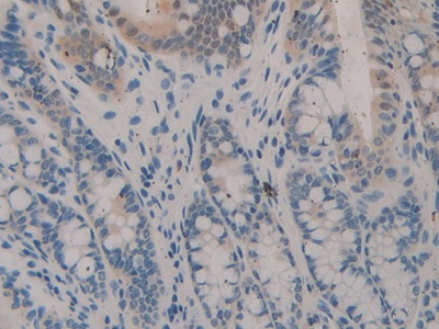 Polyclonal Antibody to Leukocyte Elastase Inhibitor (LEI)