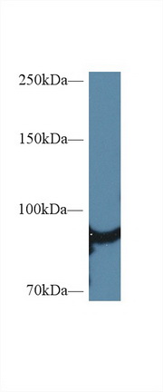 Polyclonal Antibody to Heat Shock Protein 90kDa Alpha A1 (HSP90aA1)