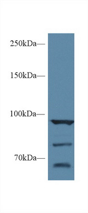 Polyclonal Antibody to Heat Shock Protein 90kDa Alpha A1 (HSP90aA1)