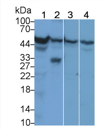 Polyclonal Antibody to Cytochrome P450 11A1 (CYP11A1)