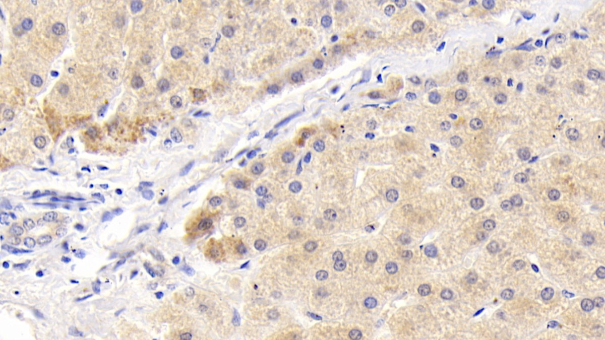 Polyclonal Antibody to Mitogen Activated Protein Kinase Associated Protein 1 (MAPKAP1)