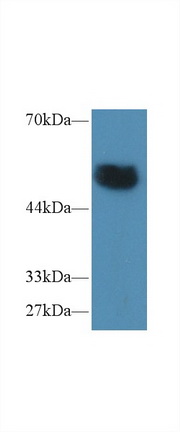 Polyclonal Antibody to Protein Tyrosine Phosphatase, Non Receptor Type 5 (PTPN5)
