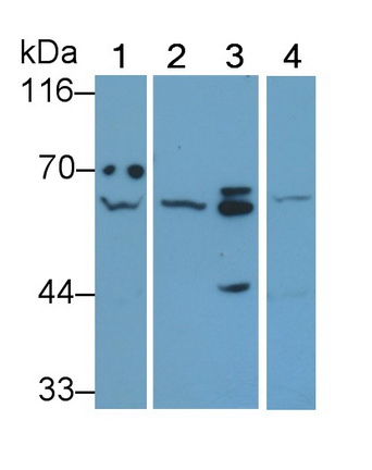 Polyclonal Antibody to Protein Tyrosine Phosphatase, Non Receptor Type 6 (PTPN6)