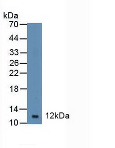 Polyclonal Antibody to Diazepam Binding Inhibitor (DBI)
