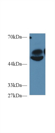 Polyclonal Antibody to Regulator Of G Protein Signaling 7 (RGS7)