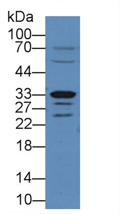 Polyclonal Antibody to Arginase II (Arg2)
