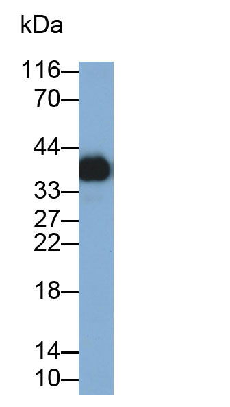 Polyclonal Antibody to Arginase II (Arg2)