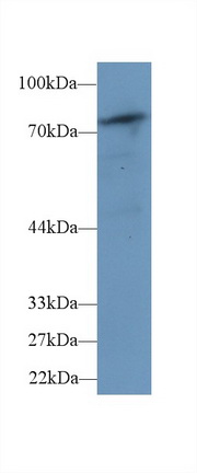 Polyclonal Antibody to Phospholipase C Delta 4 (PLCd4)