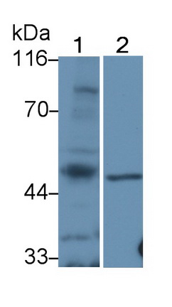 Polyclonal Antibody to Tyrosine Aminotransferase (TAT)