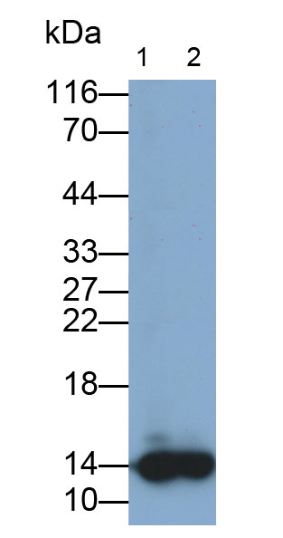 Polyclonal Antibody to Small Nuclear Ribonucleoprotein Polypeptide D2 (SNRPD2)