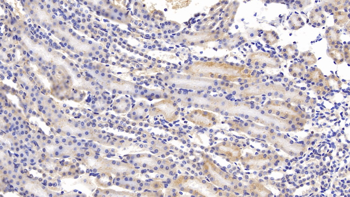 Polyclonal Antibody to Tumor Necrosis Factor Receptor Superfamily, Member 14 (TNFRSF14)