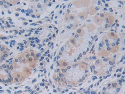 Polyclonal Antibody to Tumor Necrosis Factor Ligand Superfamily, Member 9 (TNFSF9)