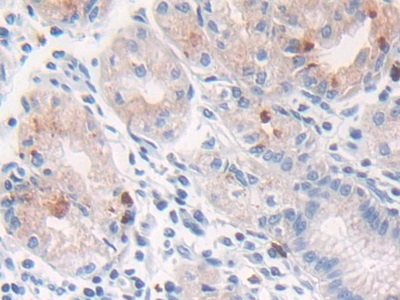 Polyclonal Antibody to Cathepsin G (CTSG)