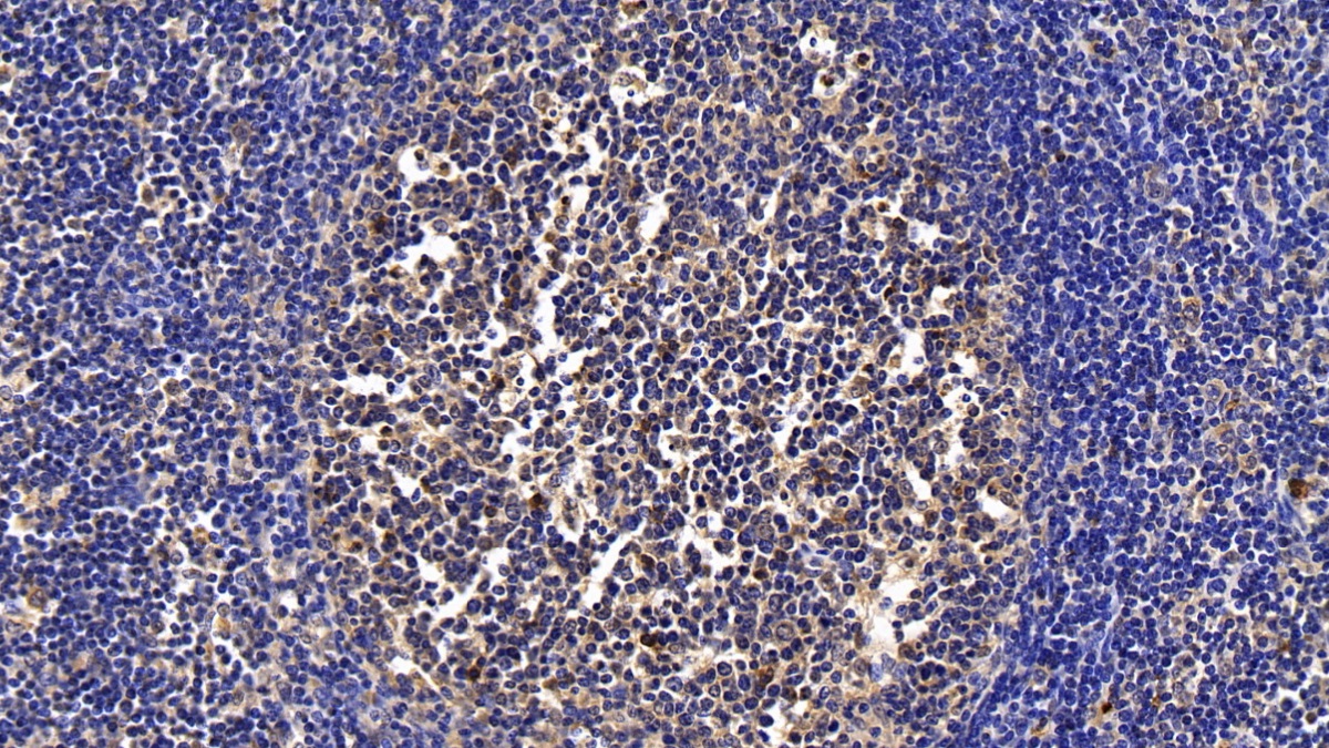 Polyclonal Antibody to Procollagen C Proteinase Enhancer 2 (PCPE2)