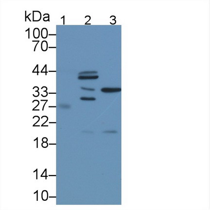 Polyclonal Antibody to Calcineurin Like Phosphoesterase Domain Containing Protein 1 (CPPED1)