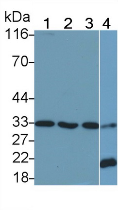 Polyclonal Antibody to Interferon Alpha/Beta Receptor 2 (IFNa/bR2)