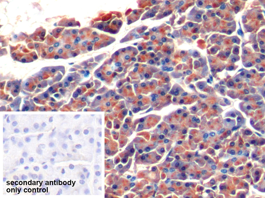 Polyclonal Antibody to Colipase, Pancreatic (CLPS)
