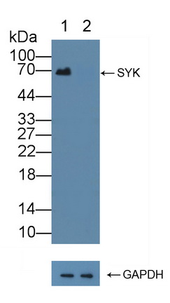 Polyclonal Antibody to Spleen Tyrosine Kinase (SYK)