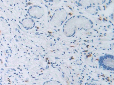 Polyclonal Antibody to Na-Cl Cotransporter (NCCT)