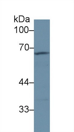 Polyclonal Antibody to Alpha-1-B-Glycoprotein (a1BG)