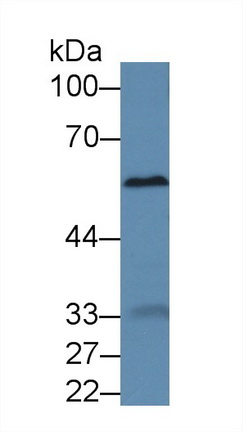 Polyclonal Antibody to Alpha-1-B-Glycoprotein (a1BG)