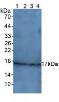 Polyclonal Antibody to Cyclin Dependent Kinase Inhibitor 1A (CDKN1A)