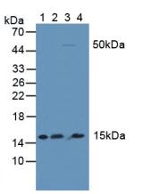 Polyclonal Antibody to Inhibitory Subunit Of NF Kappa B Delta (IkBd)