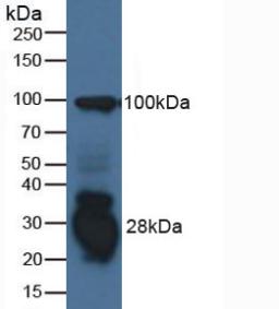 Polyclonal Antibody to Interferon Gamma Inducible Protein 30 (IFI30)