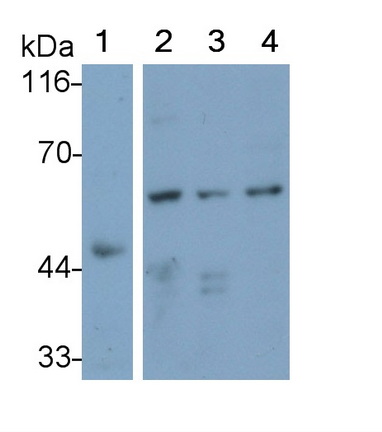 Polyclonal Antibody to Interleukin 31 Receptor A (IL31RA)