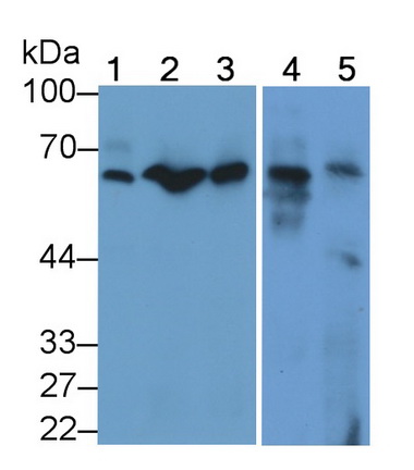 Polyclonal Antibody to Interleukin 22 Receptor (IL22R)