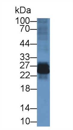 Polyclonal Antibody to Interleukin 22 Receptor Alpha 2 (IL22Ra2)