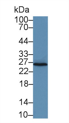 Polyclonal Antibody to Interleukin 22 Receptor Alpha 2 (IL22Ra2)