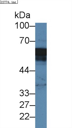 Polyclonal Antibody to Annexin A11 (ANXA11)