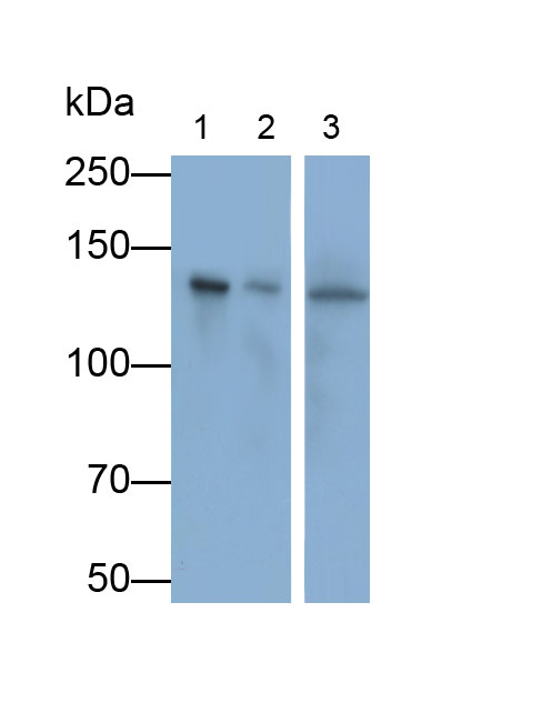 Polyclonal Antibody to Histone Deacetylase 4 (HDAC4)