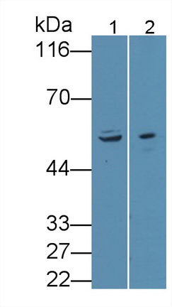 Polyclonal Antibody to Anthrax Toxin Receptor 2 (ANTXR2)