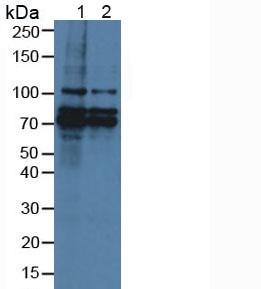 Polyclonal Antibody to Breast Carcinoma Amplified Sequence 3 (BCAS3)