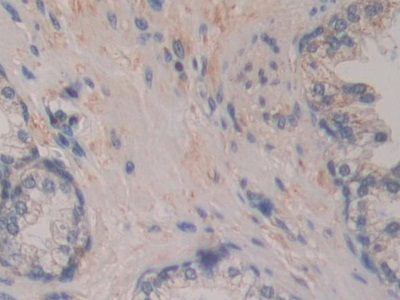 Polyclonal Antibody to Breast Carcinoma Amplified Sequence 3 (BCAS3)
