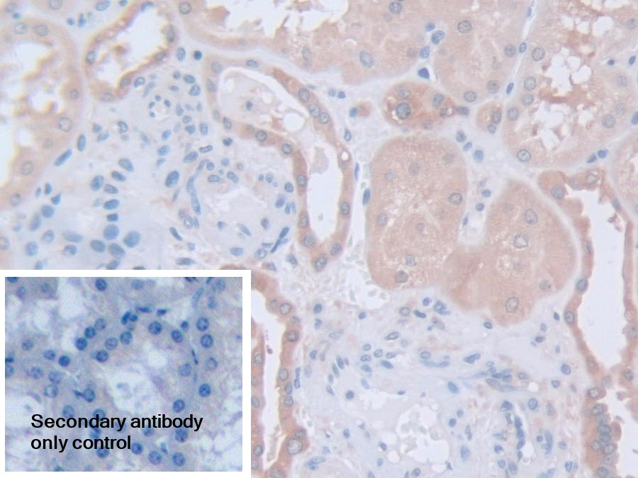 Polyclonal Antibody to Calpain, Small Subunit 1 (CAPNS1)
