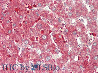 Polyclonal Antibody to Carnitine Palmitoyltransferase 1A, Liver (CPT1A)
