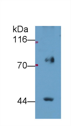 Polyclonal Antibody to Fatty Acid Desaturase 2 (FADS2)