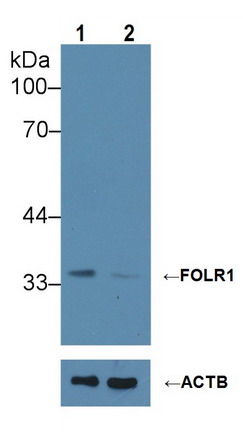 Polyclonal Antibody to Folate Receptor 1, Adult (FOLR1)