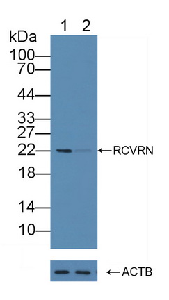 Polyclonal Antibody to Recoverin (RCVRN)