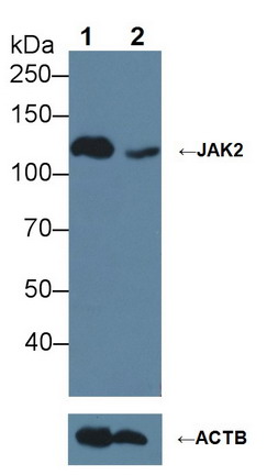 Polyclonal Antibody to Janus Kinase 2 (JAK2)