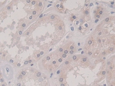 Polyclonal Antibody to Kinesin Family, Member 18A (KIF18A)