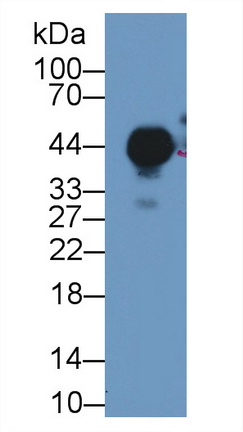 Polyclonal Antibody to Uroplakin 3A (UPK3A)